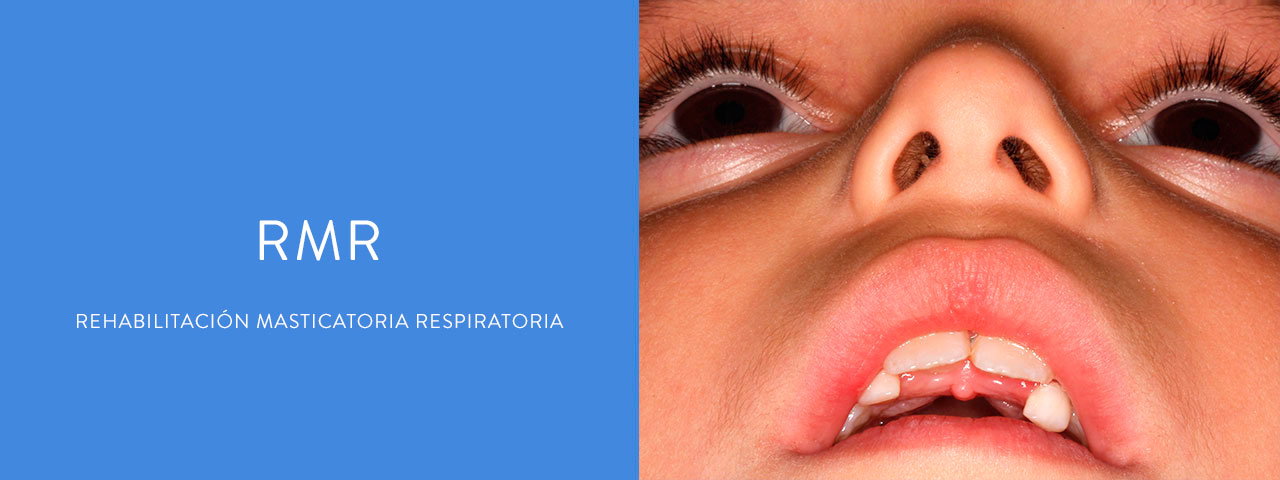 Respiración oral - RMR